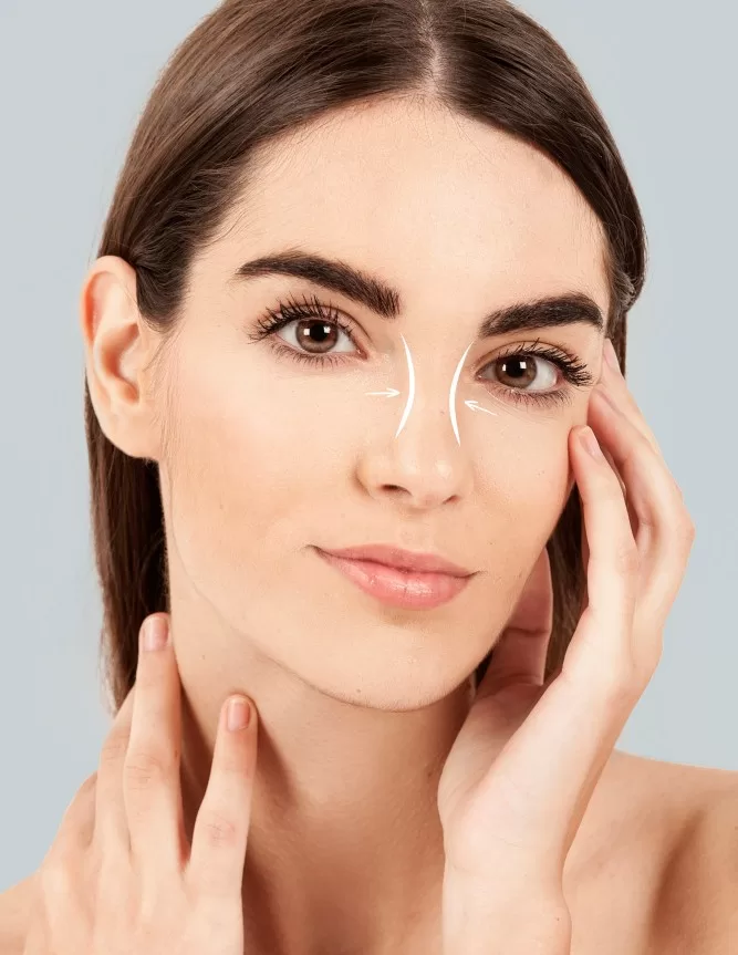 Non-Surgical Rhinoplasty