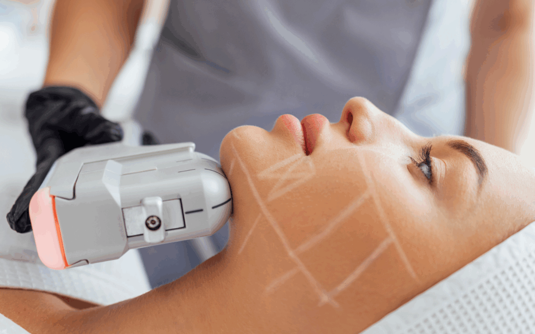 HIFU (High-Intensity Focused Ultrasound)
