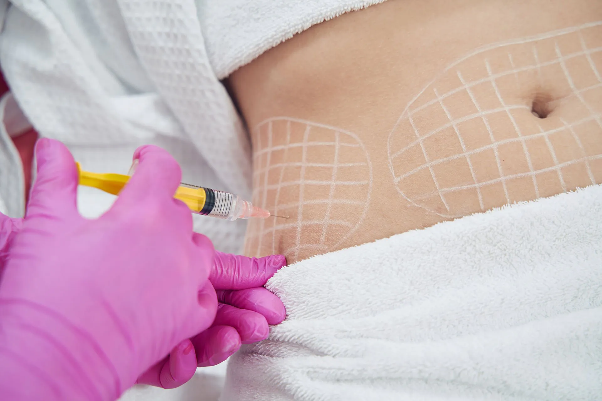 Fat Dissolving Treatment