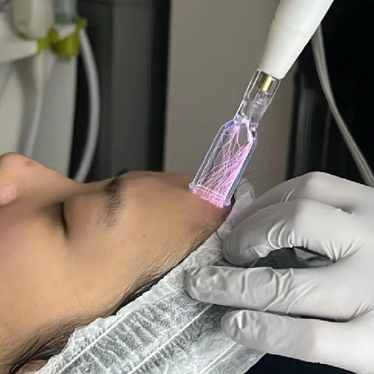 Cold and Warm Plasma