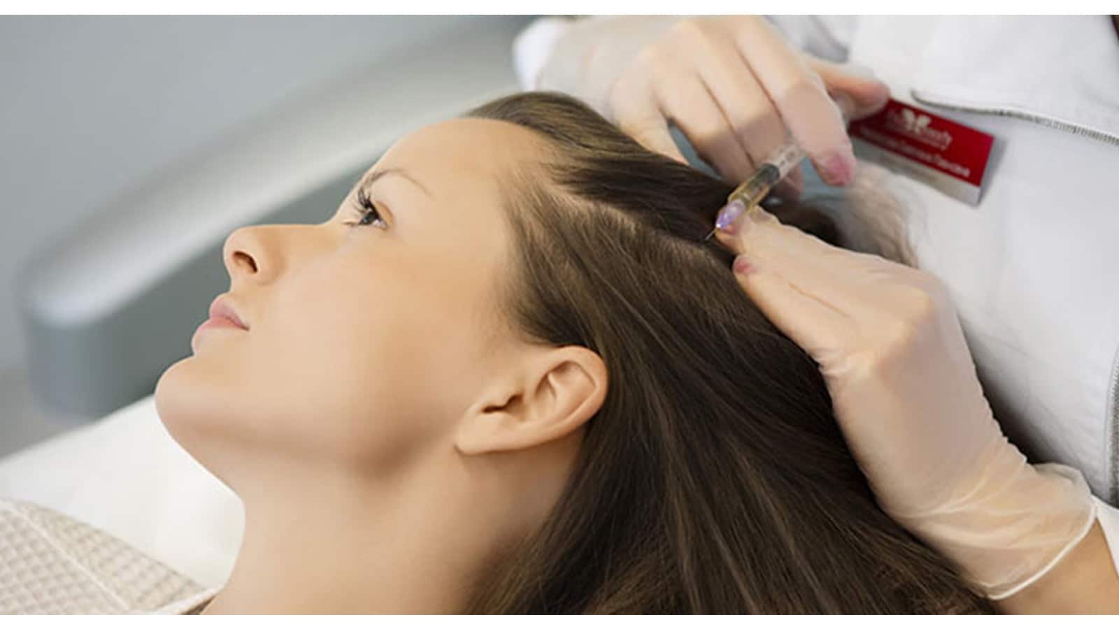 Mesotherapy for Hair Growth