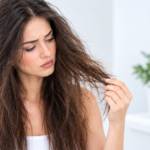 woman have dantruff hair